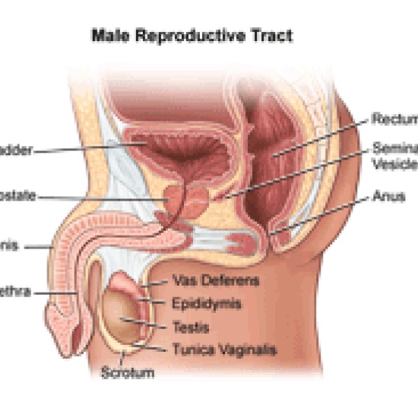Image for Prostatectomy