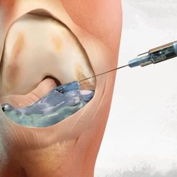 Image for Injection Therapies