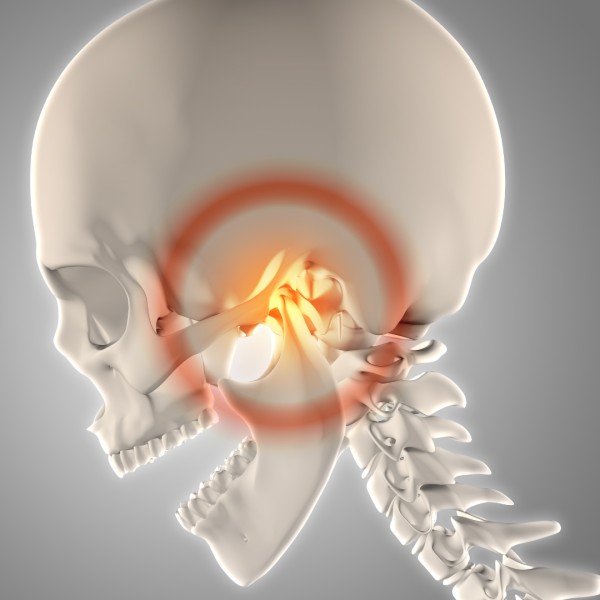 Image for Understanding Temporomandibular Disorder (TMD)